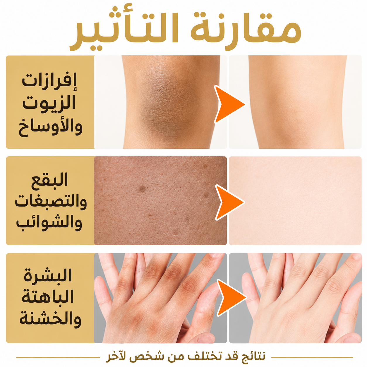زيت التقشير الذهبي