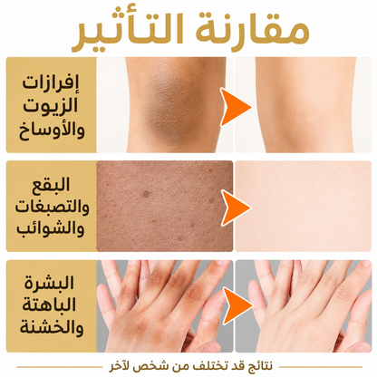 زيت التقشير الذهبي